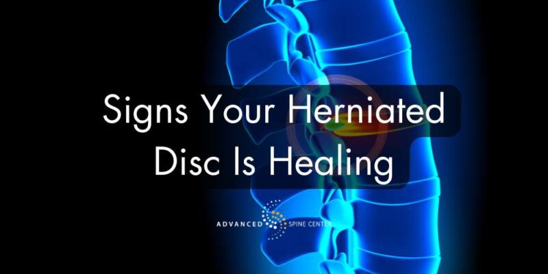 signs herniated disc is healing