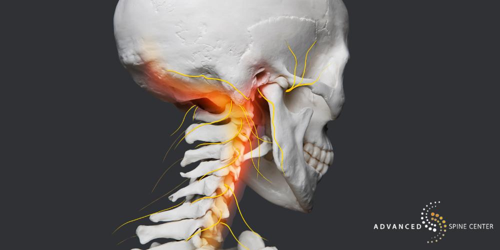 cervical medial branch block plano tx