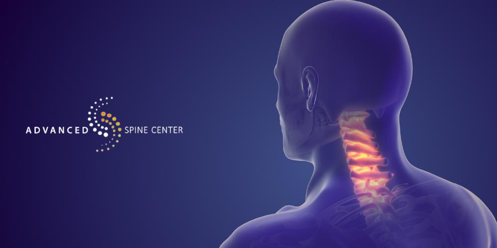 what is the best treatment for herniated discs in the neck