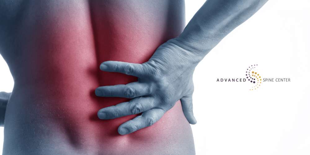 anterolisthesis vs spondylolisthesis