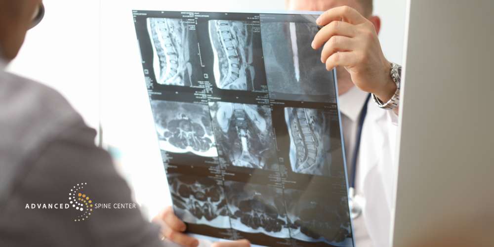 spinal stenosis surgeon plano tx