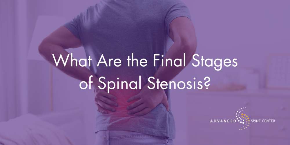 what are the final stages of spinal stenosis