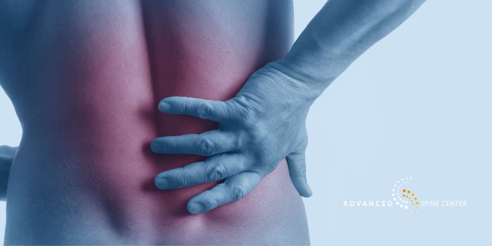 What Causes Back Spasms