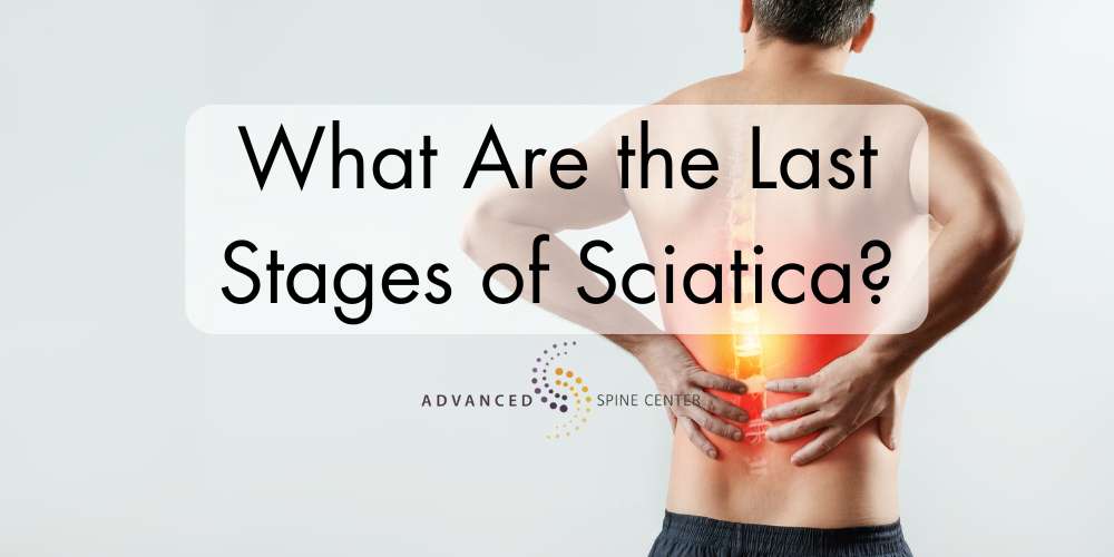 last stages of sciatica